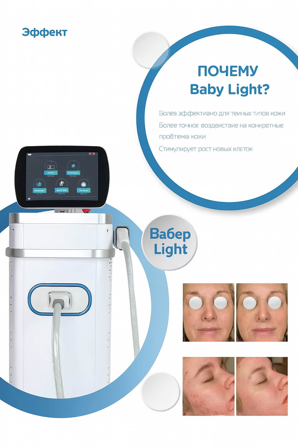 Преимущества Baby Light технологии Преимущества Baby Light технологии