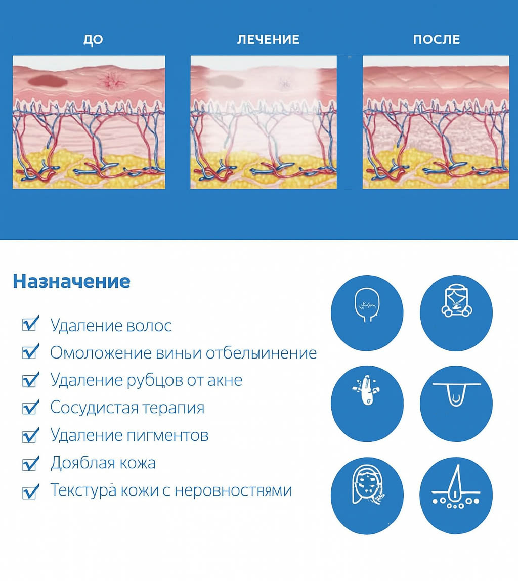 Схема воздействия Baby Light технологии Схема воздействия Baby Light технологии