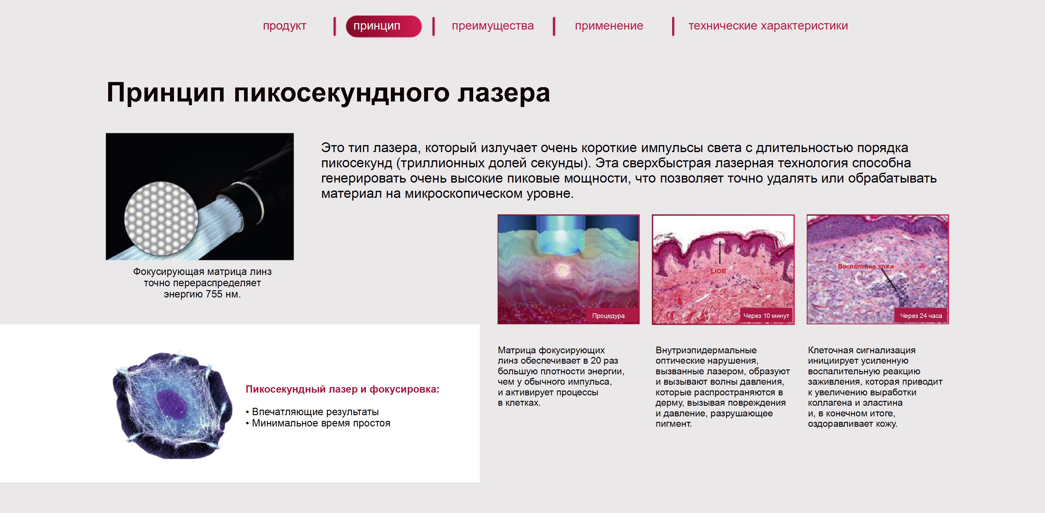 Схема принципа работы пикосекундного лазера