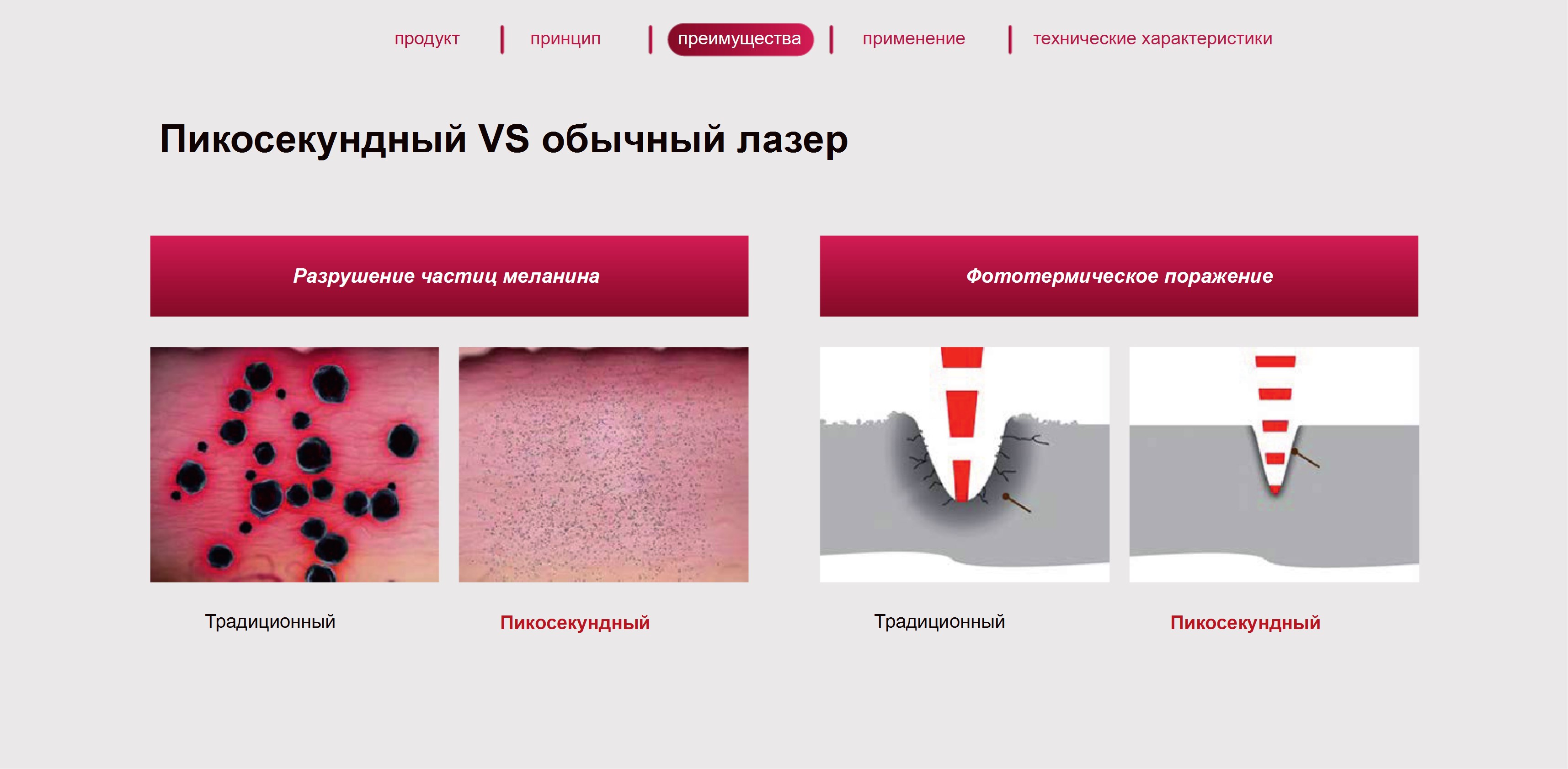 Сравнение пикосекундного и обычного лазера
