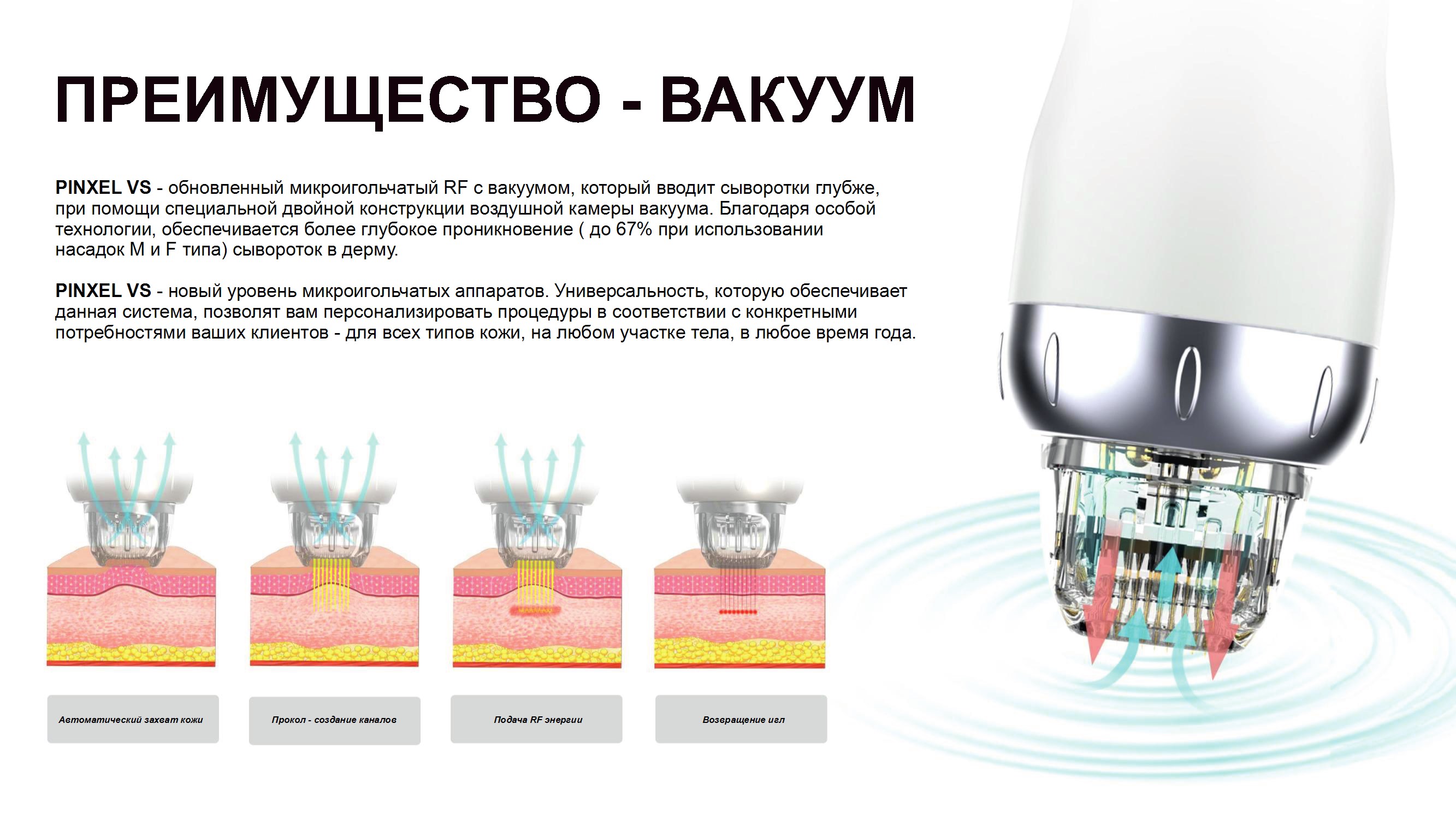 Преимущество вакуумной технологии